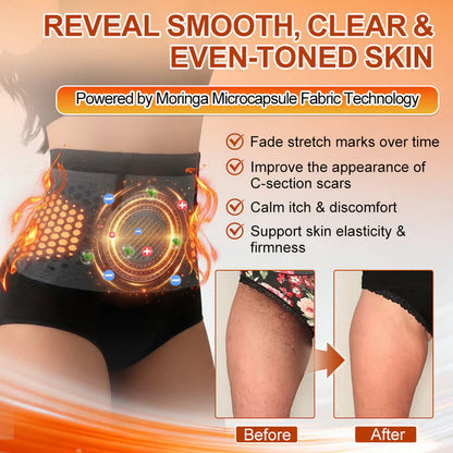 👙𝐎𝐟𝐟𝐢𝐜𝐢𝐚𝐥 𝐁𝐫𝐚𝐧𝐝 𝐒𝐭𝐨𝐫𝐞 | Von𝐮𝐭𝐫𝐢® 𝟐𝟎𝟐𝟔 𝐌𝐨𝐫𝐢𝐧𝐠𝐚 & 𝐁𝐞𝐫𝐛𝐞𝐫𝐢𝐧𝐞 𝟒-𝐈𝐧-𝟏 𝐌𝐢𝐜𝐫𝐨-𝐏𝐚𝐫𝐭𝐢𝐜𝐥𝐞 𝐒𝐜𝐮𝐥𝐩𝐭𝐢𝐧𝐠 & 𝐅𝐚𝐭-𝐁𝐮𝐫𝐧 𝐒𝐡𝐨𝐫𝐭𝐬